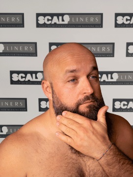 Scalpliners smp skin after care