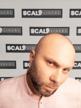 Scalpliners Hair Loss Clinic