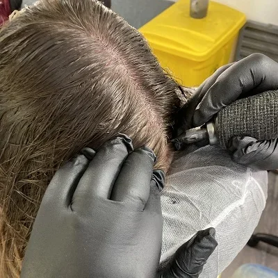 Women's scalp micropigmentation density treatment for thinning hair in Kent