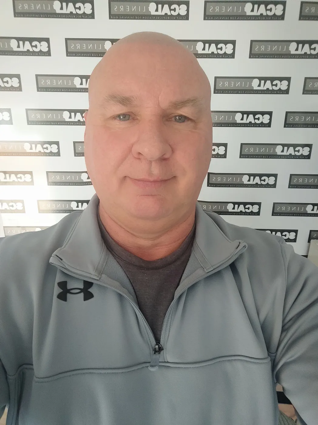 Mark Terrell, scalp micropigmentation artist at ScalpLiners Whitstable Kent